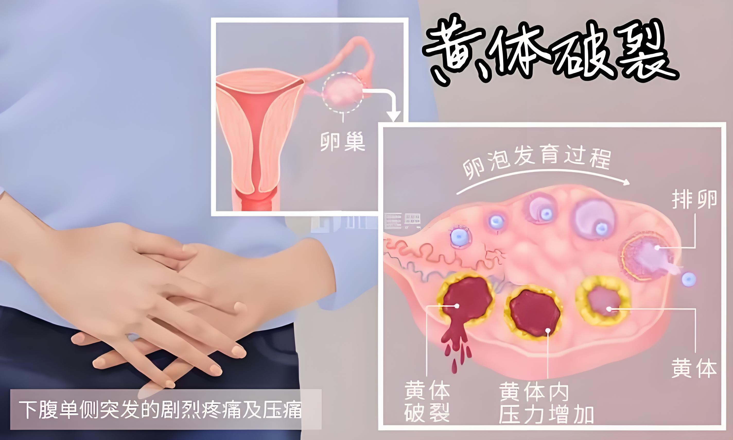 圖片 2.png